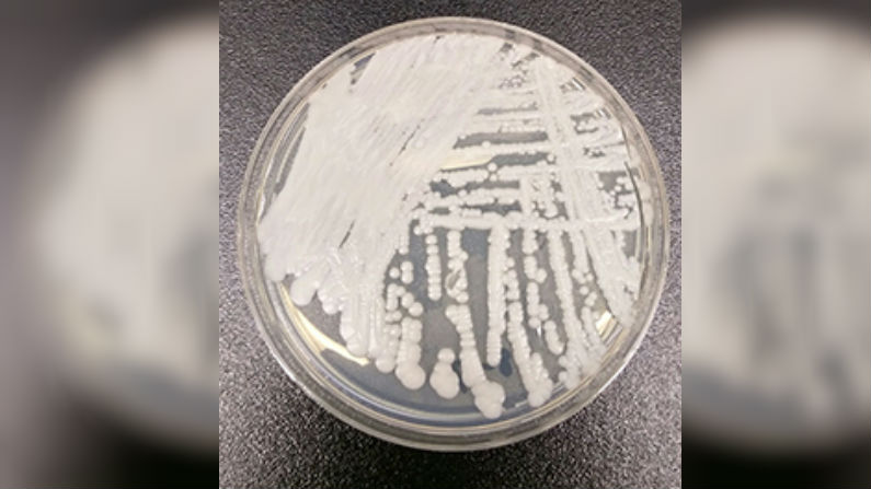 A strain of Candida auris cultured in a petri dish at a CDC laboratory.(Shawn Lockhart/Centers for Disease Control