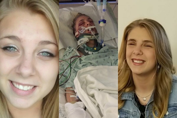 Woman Who Gouged Her Eyes out While on Drugs Vows Not to Give Up