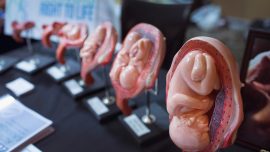 Mississippi Advances Abortion Ban After Fetal Heartbeat
