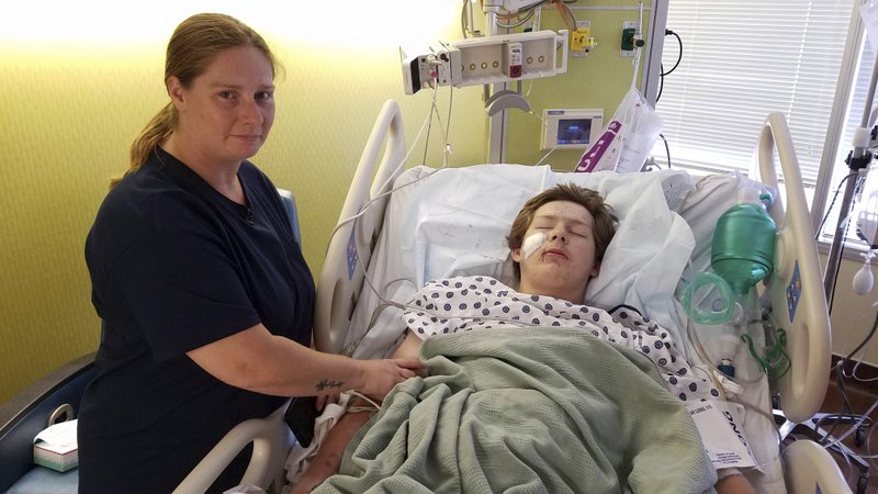 15-year-old Eli Gregg, in the hospital with his mother Jimmy Russell, after doctors removed a 10 knife that impaled his face