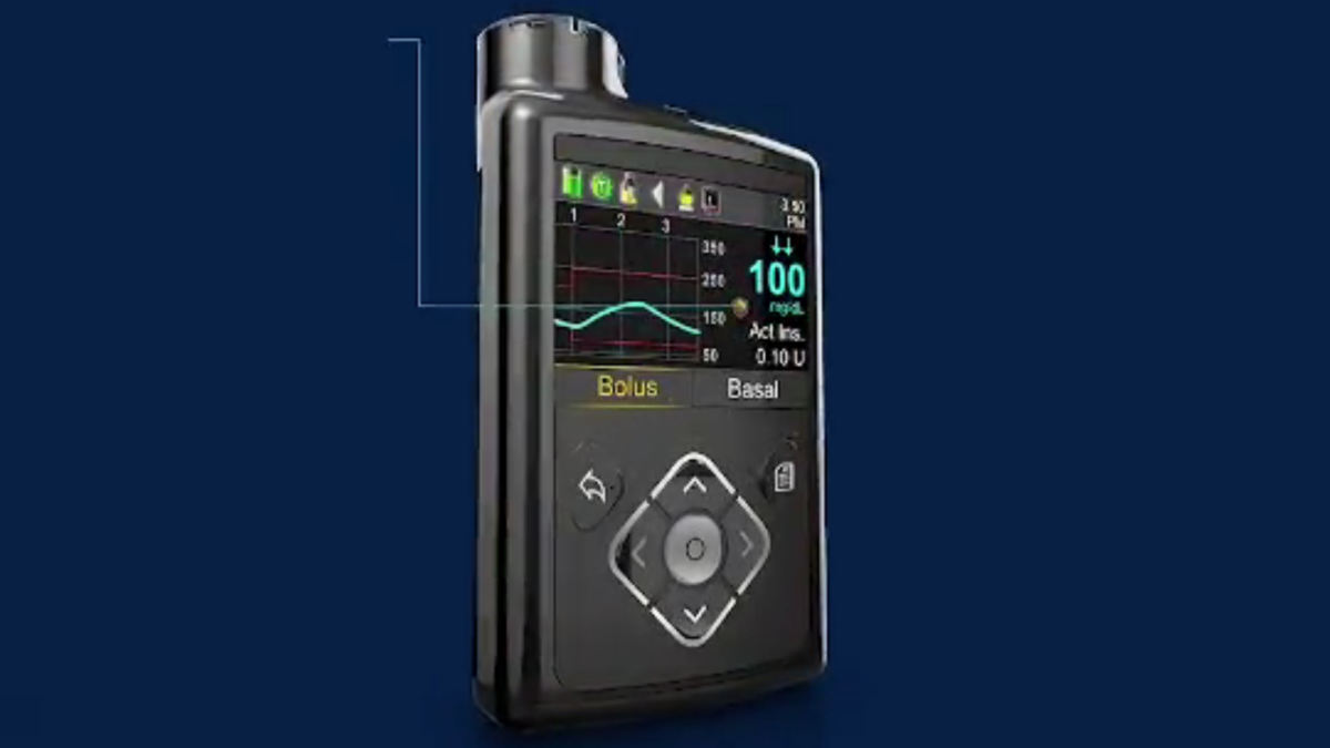Medtronic MiniMed insulin pump.