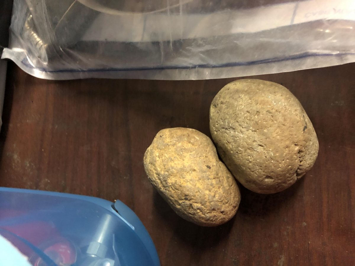 Rocks_injured portland officer