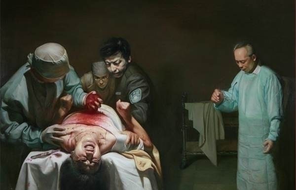 Organ-Harvesting--e1562563893729