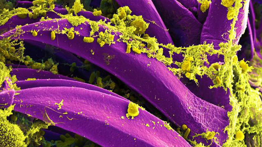 Colorado 10-Year-Old Dies as Health Officials Investigate Plague Activity