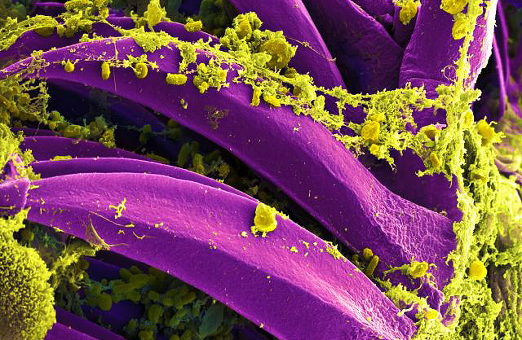 Colorado 10-Year-Old Dies as Health Officials Investigate Plague Activity