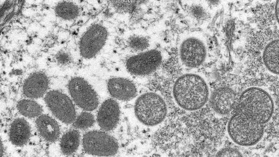 First Monkeypox Case Confirmed in US Military Service Member: Spokesperson